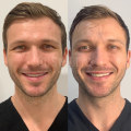 The Ultimate Guide to Achieving Youthful Skin for Men