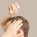 The Ultimate Guide to Maintaining a Healthy Scalp for Men: Tips from a Dermatologist