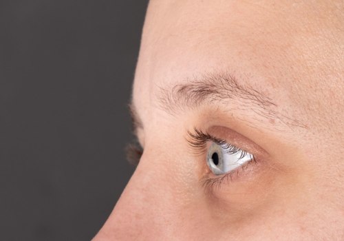 Expert Tips for Men's Skincare: Balding and Thinning Eyebrows