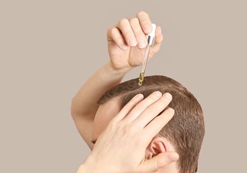 The Ultimate Guide to Maintaining a Healthy Scalp for Men: Tips from a Dermatologist